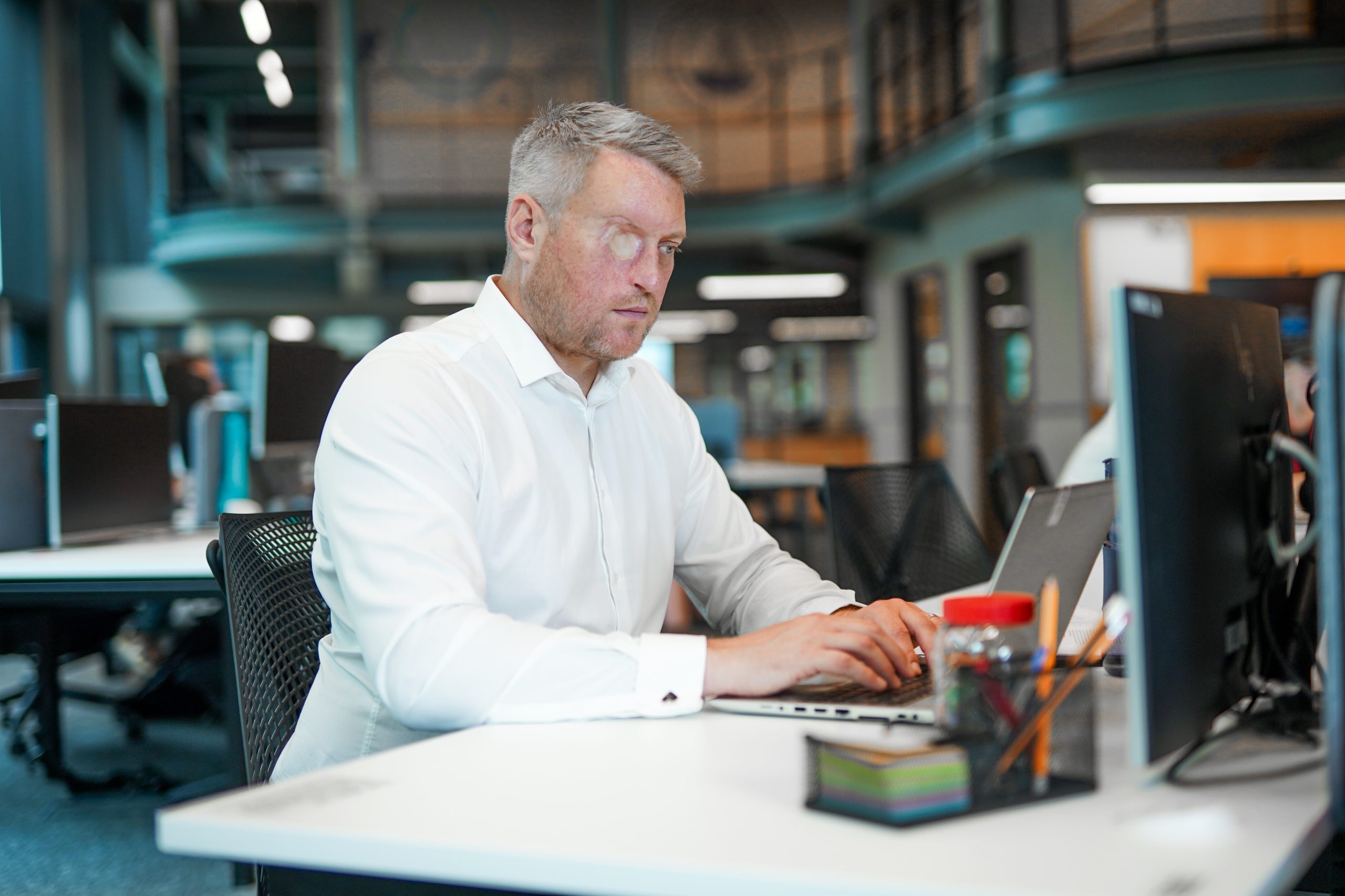 Person with facial difference and sight loss works at laptop at desk in office